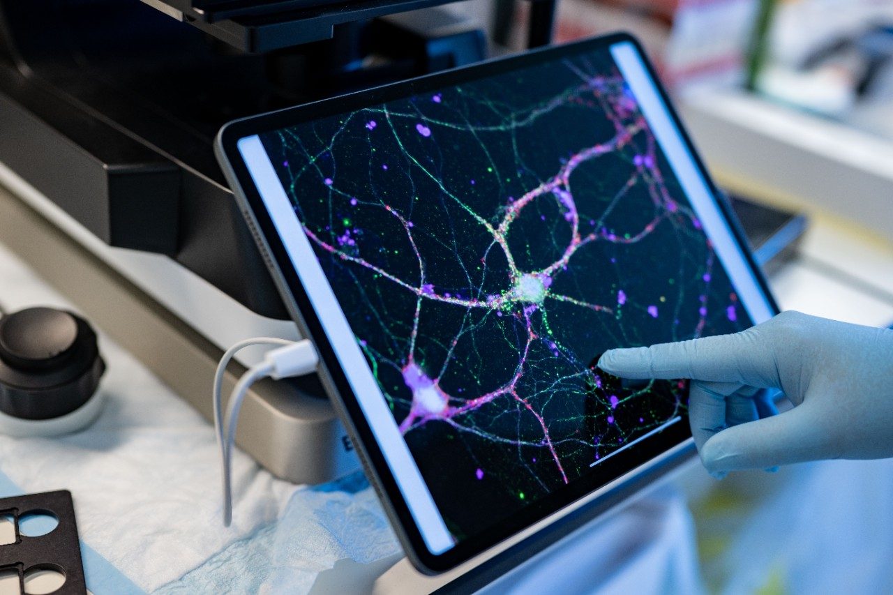 Close-up of computer screen with photo of neurons